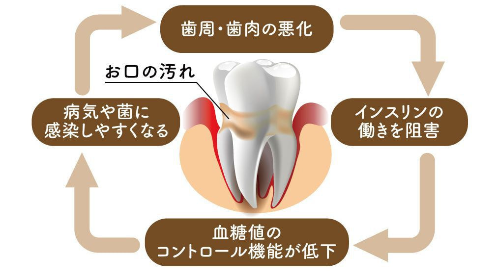歯周病の怖いサークル