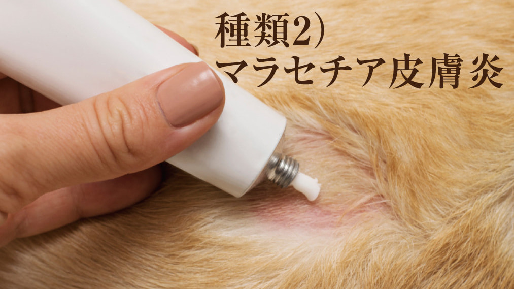マラセチア皮膚炎